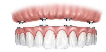 Teeth Image Teeth Image