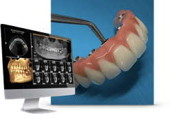 all-one-2 Predent Patient Journey