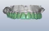 green-teeth Predent Teeth Image
