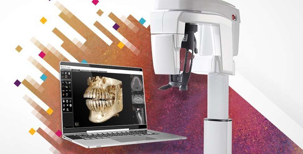 implant-bone-scanning-bg