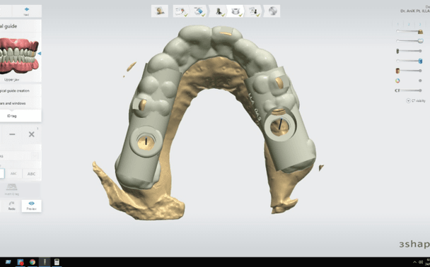 monitor-jaw